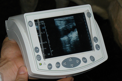 ultrasonografia transrettale, ecografia