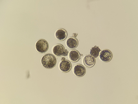 embryotransfer, ovum pick up, fertilizzazione in vitro, Eduardo Benedetti, Siet