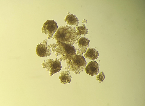 embryotransfer, ovum pick up, fertilizzazione in vitro, Eduardo Benedetti, Siet